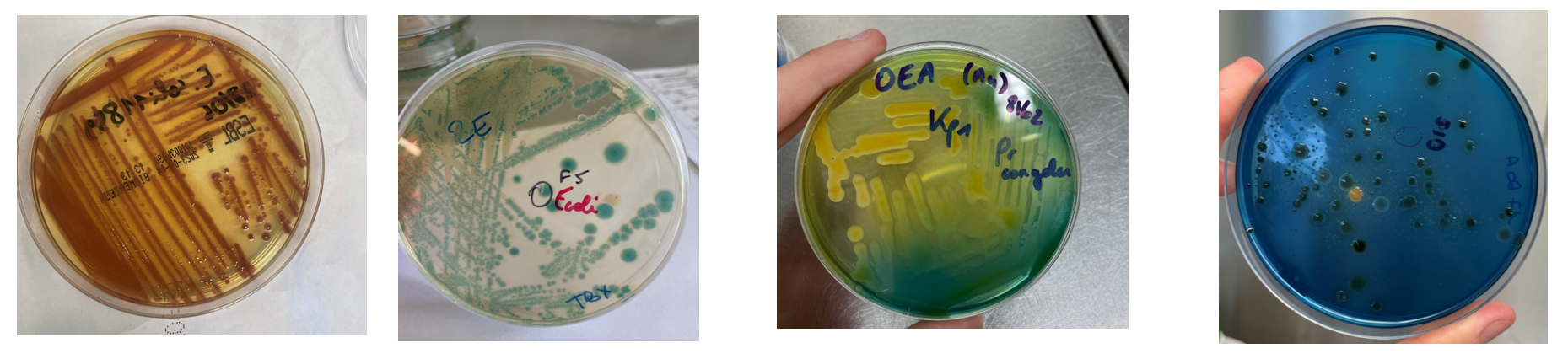 BacteriaDetection